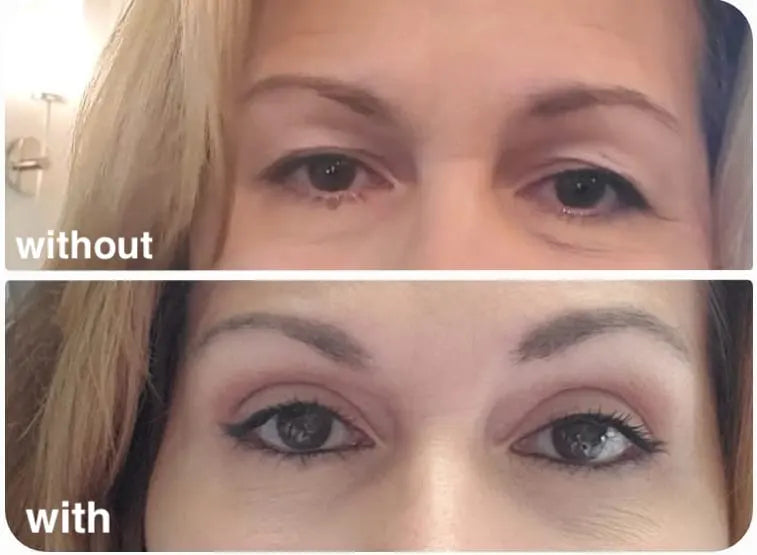 Invisible Eyelid Strips™