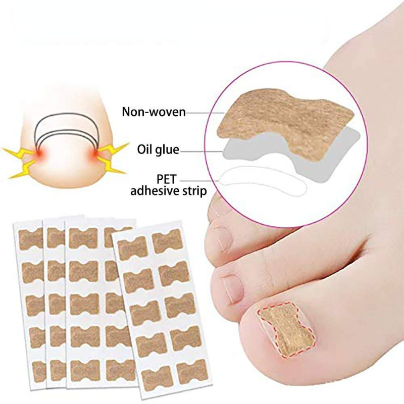 Nail Correction Patches™