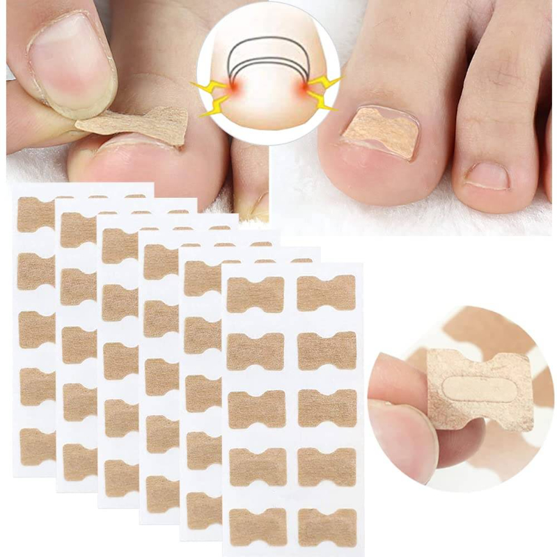 Nail Correction Patches™